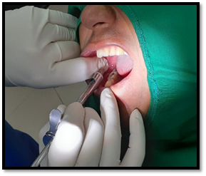Una mujer con cepillo de dientes en la boca
Descripción generada automáticamente con confianza baja